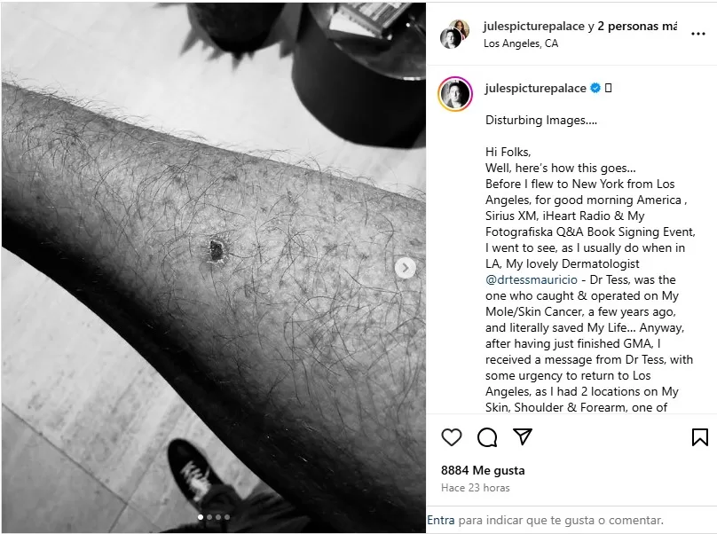 Publicación donde Julian Lennon anunció su problema médico | @julespicturepalace | Instagram